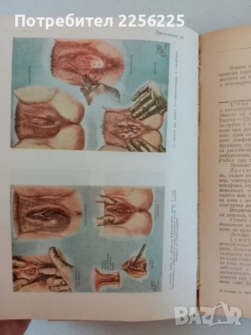 Гинекология, снимка 5 - Специализирана литература - 47482609