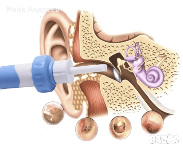 Електрически аспиратор за уши , снимка 3 - Друга електроника - 53890833