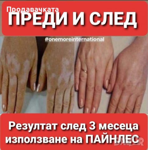 Пластири (Пейнлес) PAINLESS  налични! One More за определени заболявания, снимка 12 - Други - 36364317