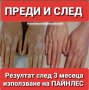 Пластири (Пейнлес) PAINLESS  налични! One More за определени заболявания, снимка 12