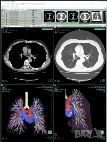 Quadro radiforce RTX 4000 EIZO MED-XN92 Medical/за медицинска диагностика, снимка 3 - Видеокарти - 53309394