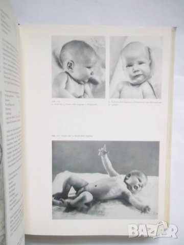 Книга Der nackte Mensch - Gottfried Bammes 1969 г. Годфрид Бамес, снимка 6 - Други - 30687316