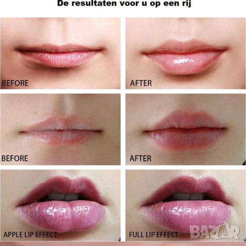 Силиконово устройство за уголемяване на устни, Без инжектиране, Мигновен ефект, снимка 3 - Други - 50935966