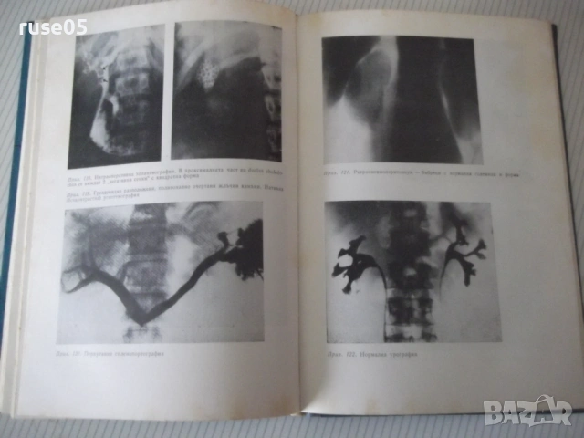 Книга "Рентгенология и радиология - Ив. Ушев" - 328 стр., снимка 7 - Специализирана литература - 53221897