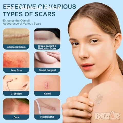 Нов Силиконов гел против белези, стрии, акне, хирургични белези 50мл, снимка 4 - Други - 50654595