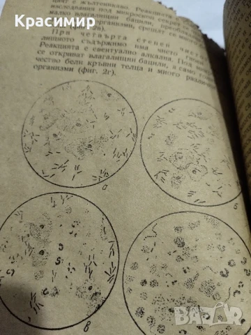 Течение и кръвотечение у жената., снимка 4 - Антикварни и старинни предмети - 51153241