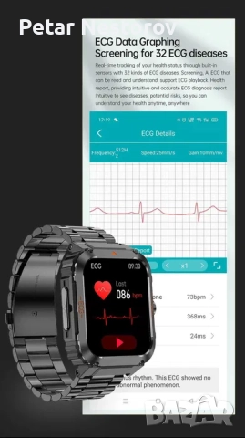 Здравен смарт часовник ЕТ550 - пулс, кръвно, ЕКГ, кръвна захар, снимка 2 - Смарт гривни - 52386135