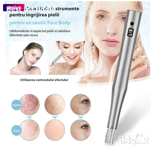 Микро игла за кожа, Chucai, 3 скорости, Сив , снимка 1