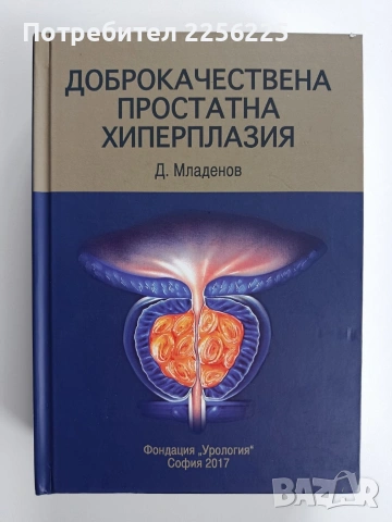 Доброкачествена простатната хиперплазия