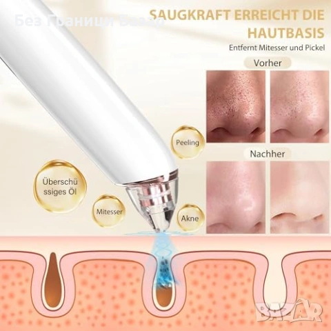 Нов вакуум Уред за лице против черни точки с 6 приставки и регулируема мощност, снимка 5 - Други - 53202913