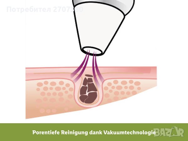 Уред за почистване на пори Sanitas, снимка 2 - Други - 39130709