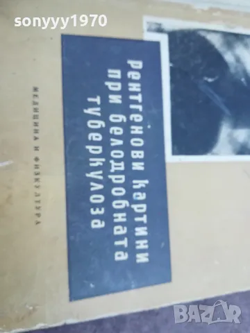 ТУБЕРКОЛОЗА 2210241119, снимка 7 - Специализирана литература - 47673891