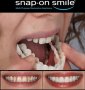 Подарете си перфектна усмивка с иновативната протеза Snap-On Smile