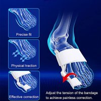 Нов Разделител за пръстите на краката Сепаратор за Изправяне Шина, снимка 3 - Други - 40283179