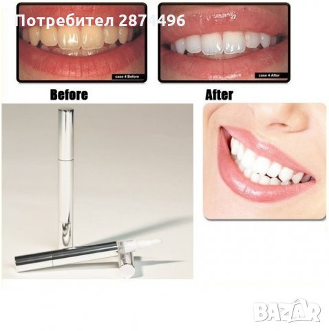 0745 Писалка за избелване на зъби, снимка 4 - Други - 30933817