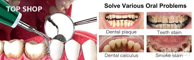 Комплект за почистване на зъби и зъбен камък LB1, снимка 5 - Стоматология - 48670414