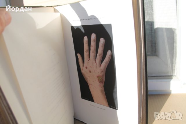 Френска медицинска книга за кожни заболявания, снимка 10 - Специализирана литература - 42654446