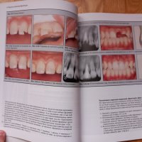 Травматизирани зъби- лечение, Митсухиро Тсукибоши, снимка 6 - Специализирана литература - 43910903