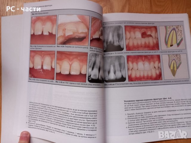 Травматизирани зъби- лечение, Митсухиро Тсукибоши, снимка 6 - Специализирана литература - 43910903