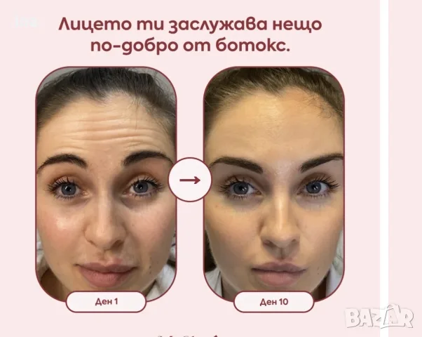 силиконови пластири против бръчки, снимка 5 - Козметика за лице - 56485954