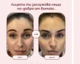силиконови пластири против бръчки, снимка 5