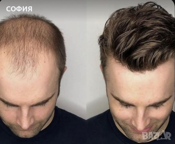 ПРОМОЦИЯ! Мъжки системи от естествена коса, снимка 3 - Аксесоари за коса - 42867069