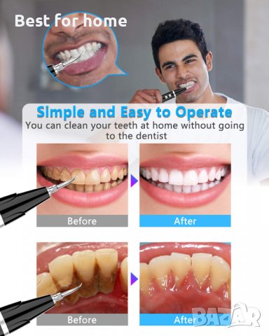 Ултразвуков уред за почистване на зъби - плака и зъбен камък, снимка 10 - Друго оборудване - 38892436