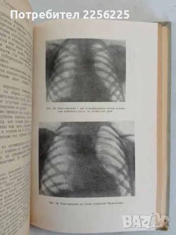 Учебник по детски болести, снимка 7 - Специализирана литература - 47482853