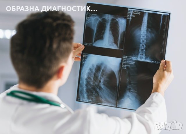 РЕНТГЕН ВАРНА, РАЗЧИТАНЕ НА РЕНТГЕНОГРАФИИ, РЕНТГЕНОВИ СНИМКИ. ВТОРО МНЕНИЕ ЗА РЕНТГЕНОГРАФИЯ, снимка 1