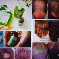 натурална козметика за растеж на косата, снимка 1 - Продукти за коса - 44698243