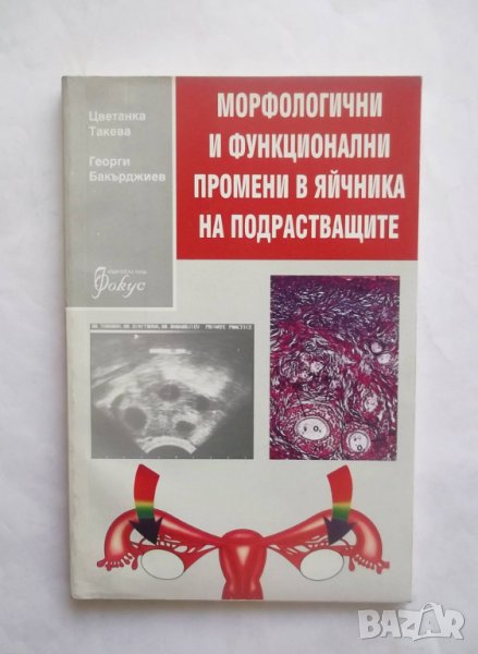 Книга Морфологични и функционални промени в яйчника на подрастващите - Цветанка Такева 1996 г., снимка 1