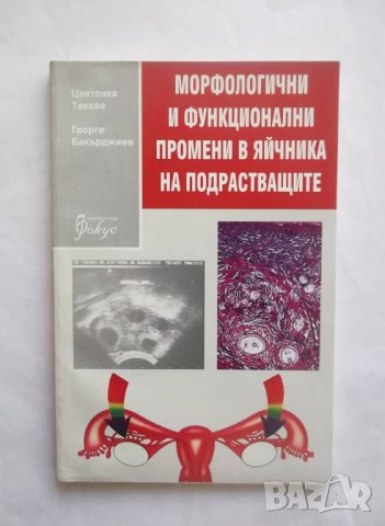 Книга Морфологични и функционални промени в яйчника на подрастващите - Цветанка Такева 1996 г., снимка 1