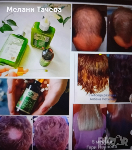 натурална козметика за растеж на косата, снимка 1 - Продукти за коса - 44698243