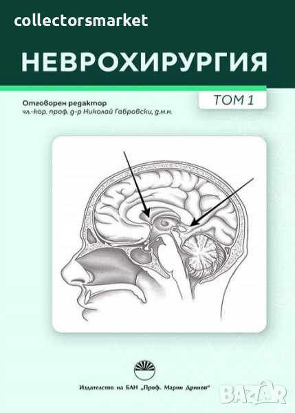 Неврохирургия. Том 1, снимка 1