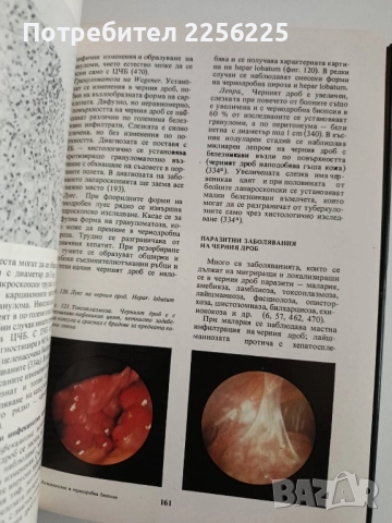 Лапароскопия и чернодробна биопсия, снимка 2 - Специализирана литература - 52168697