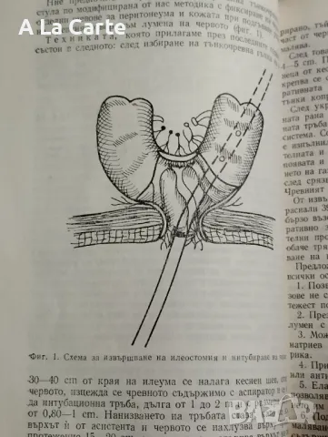 Релапаротомии, снимка 7 - Специализирана литература - 47944365