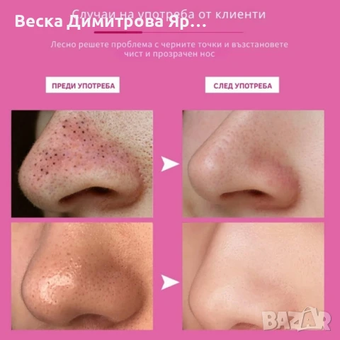 10 броя ленти за премахване на черни точки Nose Mask, снимка 10 - Други - 51202732