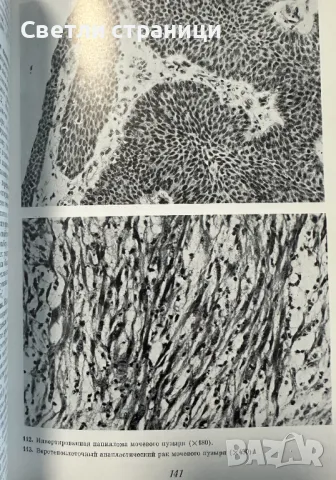 Ошибки и трудностей гистологической диагностики опухолей, снимка 2 - Специализирана литература - 48316497
