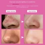 10 броя ленти за премахване на черни точки Nose Mask, снимка 10