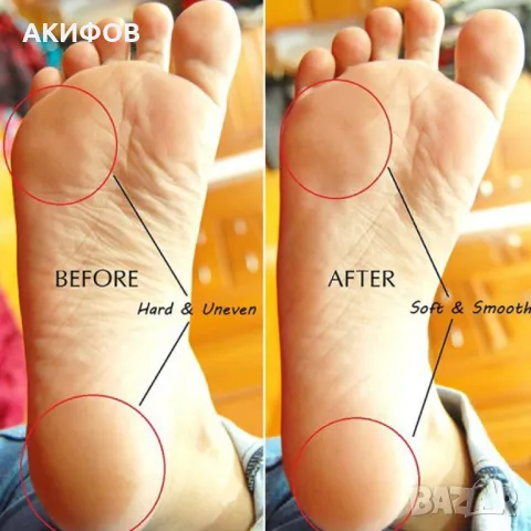Уред за гладки пети и стъпала Instant Hard Skin Remover, снимка 3 - Електрически пили за пети - 49321837