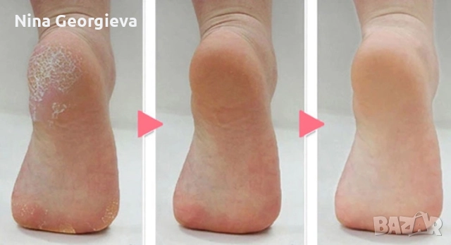 Електрически уред за пилинг на пети и кожички, снимка 8 - Други инструменти - 51897000