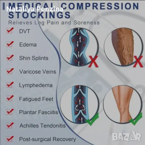 Медицински компресионни чорапи Beister с високи бедра и силиконова лента. За жени и мъже, снимка 6 - Дамски чорапи - 48510587