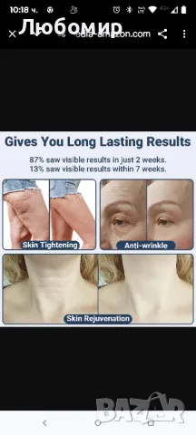 RF радиочестотна машина за лице - TUMAKOU RF устройство за стягане на кожата , снимка 10 - Други - 49855514