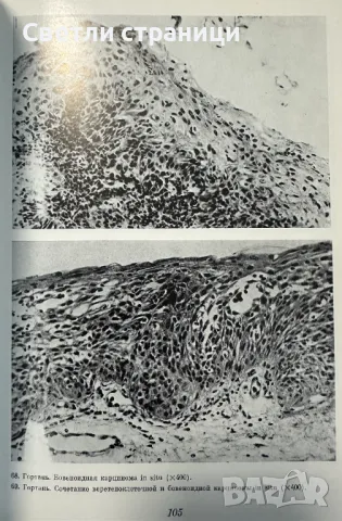 Ошибки и трудностей гистологической диагностики опухолей, снимка 3 - Специализирана литература - 48316497