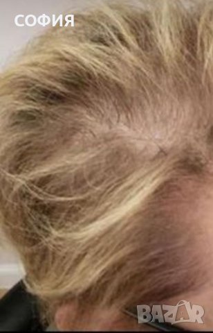 Тупета и перуки, снимка 10 - Аксесоари за коса - 40446175