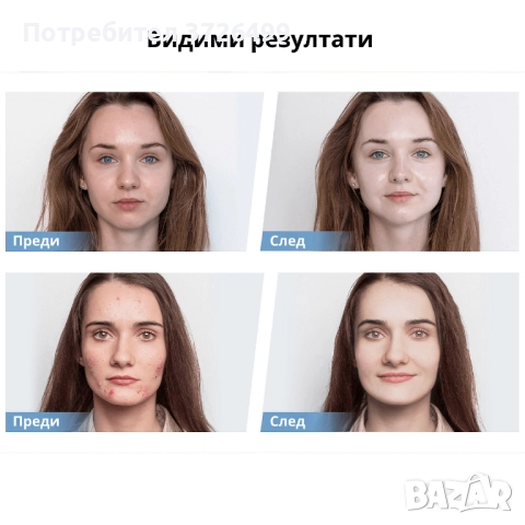 HydraPen H5 от Dr. Pen – микронидлинг и EMS за подмладяване, снимка 4 - Козметика за лице - 51630658