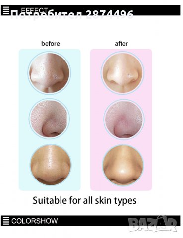 1896 Вакуумен уред за премахване на черни точки, снимка 6 - Козметика за лице - 30895780