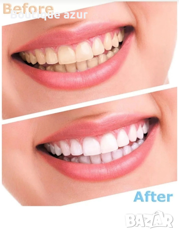 сет за избелване на зъби , снимка 2 - Други - 44679615