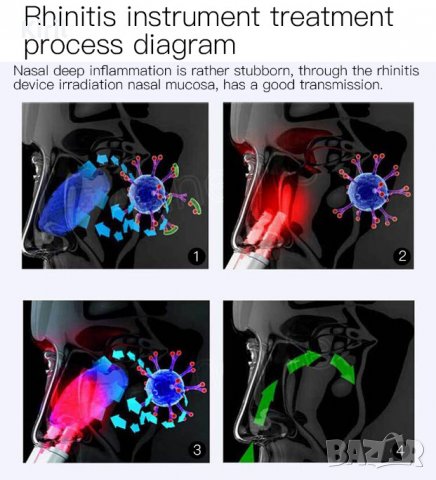 BioNase БиоНасе уникален уред за лазерна терапия и лечение на хрема, алергичен ренинт и синузит, снимка 8 - Други - 39778075