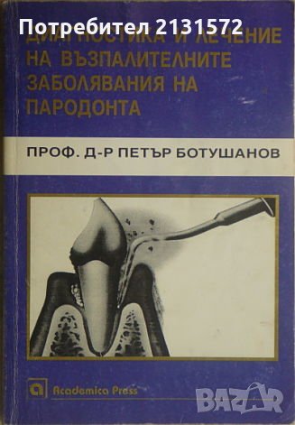 Диагностика и лечение на възпалителните заболявания на пародонта, снимка 1